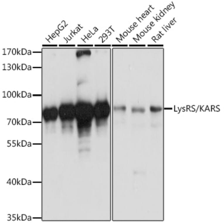 Western Blot - Anti-LysRS Antibody (A91138) - Antibodies.com