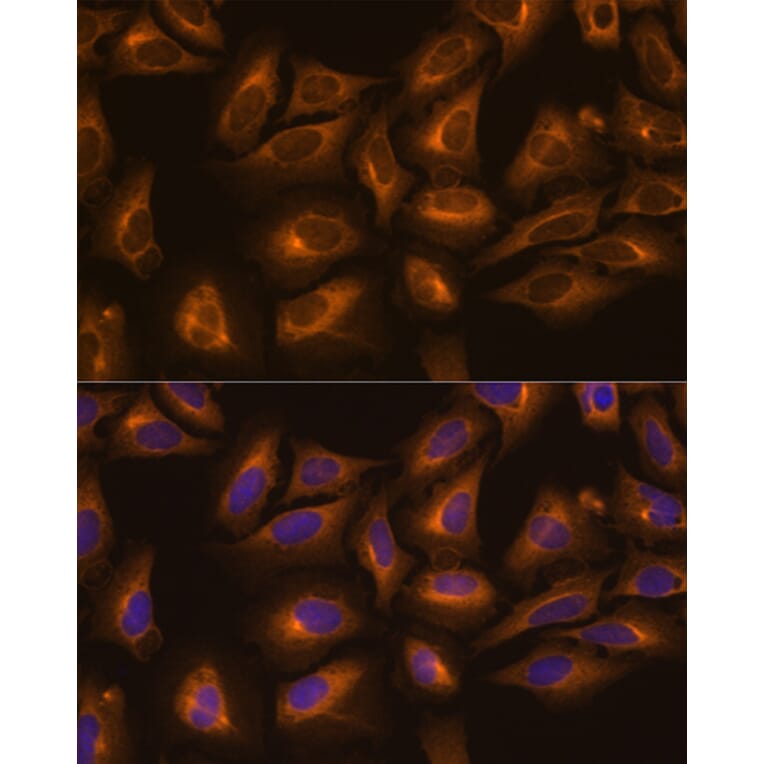 Immunofluorescence - Anti-LysRS Antibody (A91138) - Antibodies.com