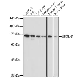 Western Blot - Anti-CIP75 Antibody (A91139) - Antibodies.com