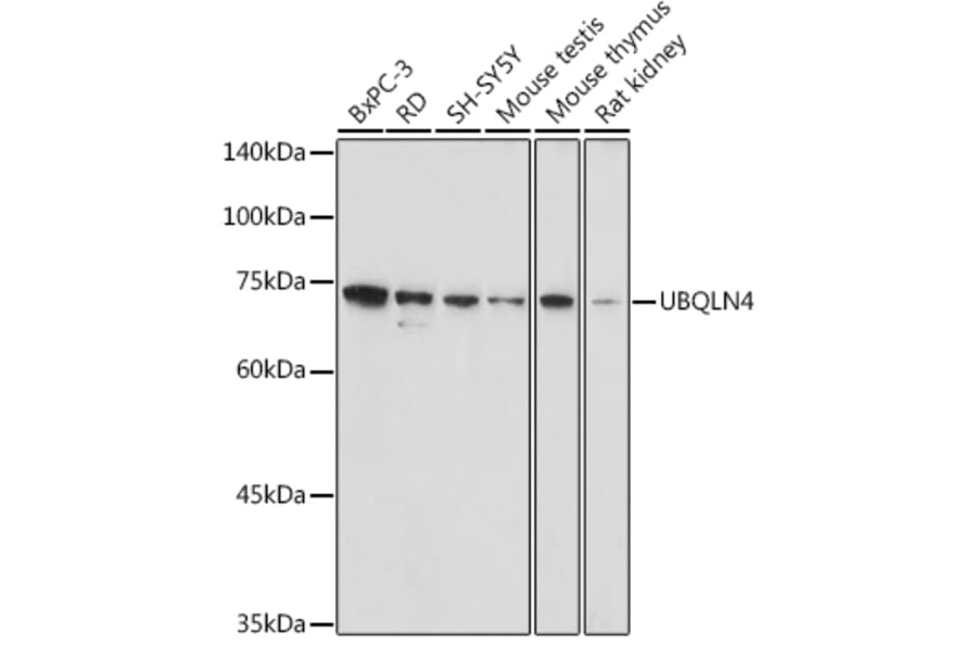 Western Blot - Anti-CIP75 Antibody (A91139) - Antibodies.com