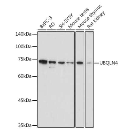 Western Blot - Anti-CIP75 Antibody (A91139) - Antibodies.com