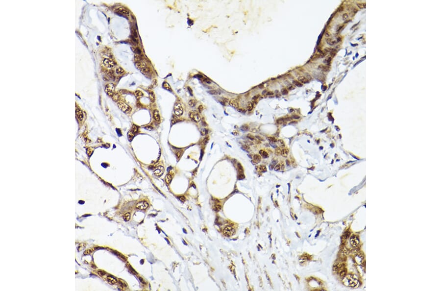 Immunohistochemistry - Anti-CIP75 Antibody (A91139) - Antibodies.com