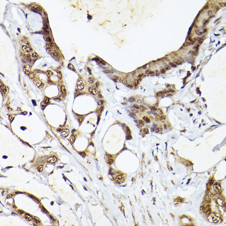 Immunohistochemistry - Anti-CIP75 Antibody (A91139) - Antibodies.com