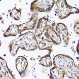 Immunohistochemistry - Anti-CIP75 Antibody (A91139) - Antibodies.com