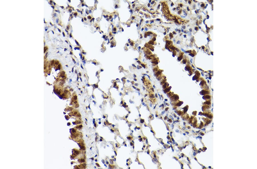 Immunohistochemistry - Anti-CIP75 Antibody (A91139) - Antibodies.com