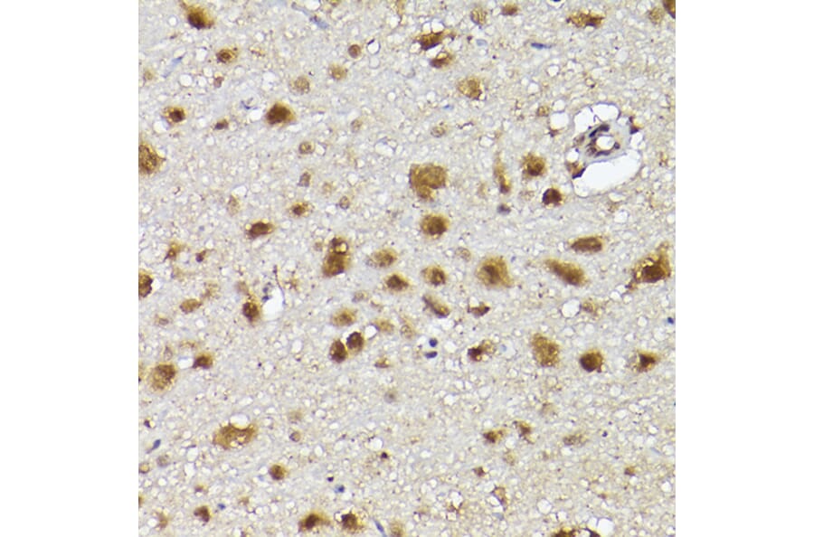 Immunohistochemistry - Anti-CIP75 Antibody (A91139) - Antibodies.com