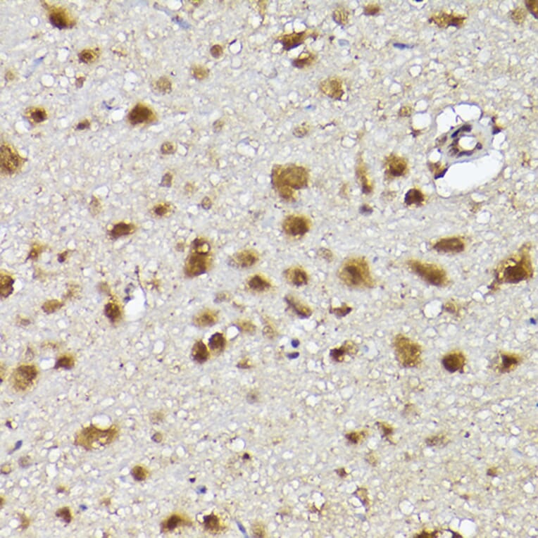 Immunohistochemistry - Anti-CIP75 Antibody (A91139) - Antibodies.com