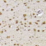 Immunohistochemistry - Anti-CIP75 Antibody (A91139) - Antibodies.com