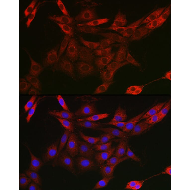 Immunofluorescence - Anti-CIP75 Antibody (A91139) - Antibodies.com