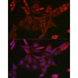 Immunofluorescence - Anti-CIP75 Antibody (A91139) - Antibodies.com