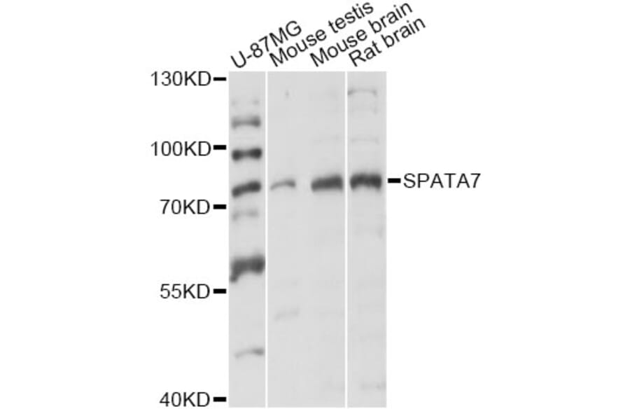 Western Blot - Anti-SPATA7 Antibody (A14285) - Antibodies.com