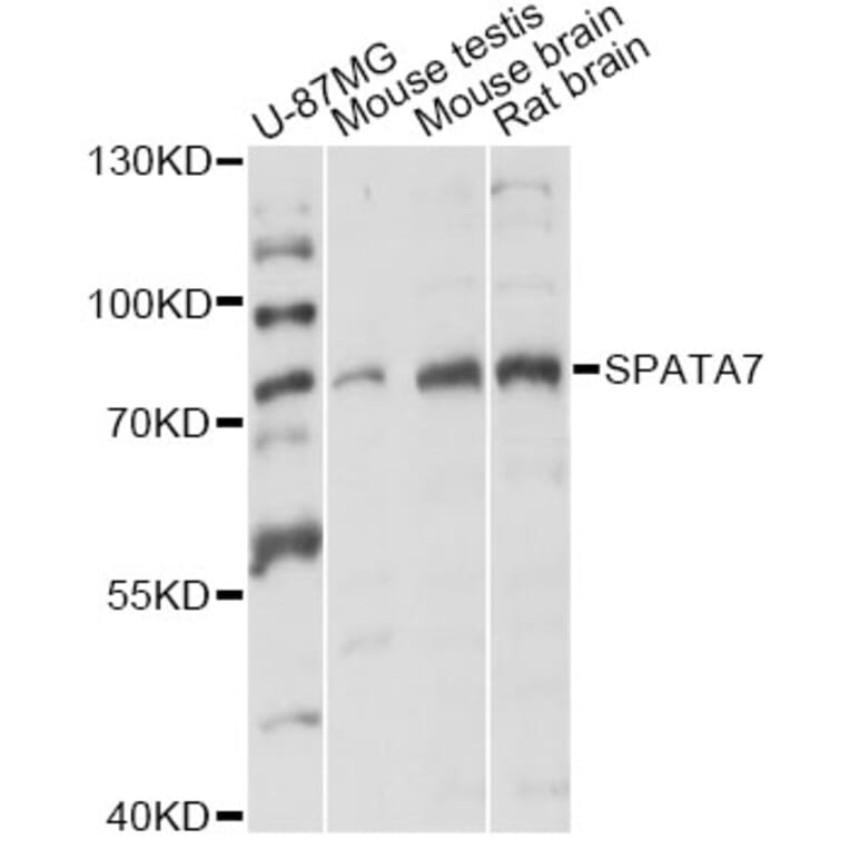 Western Blot - Anti-SPATA7 Antibody (A14285) - Antibodies.com