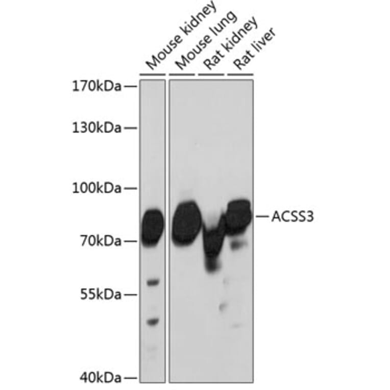 Western Blot - Anti-ACSS3 Antibody (A91141) - Antibodies.com