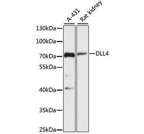 Western Blot - Anti-DLL4 Antibody (A91142) - Antibodies.com