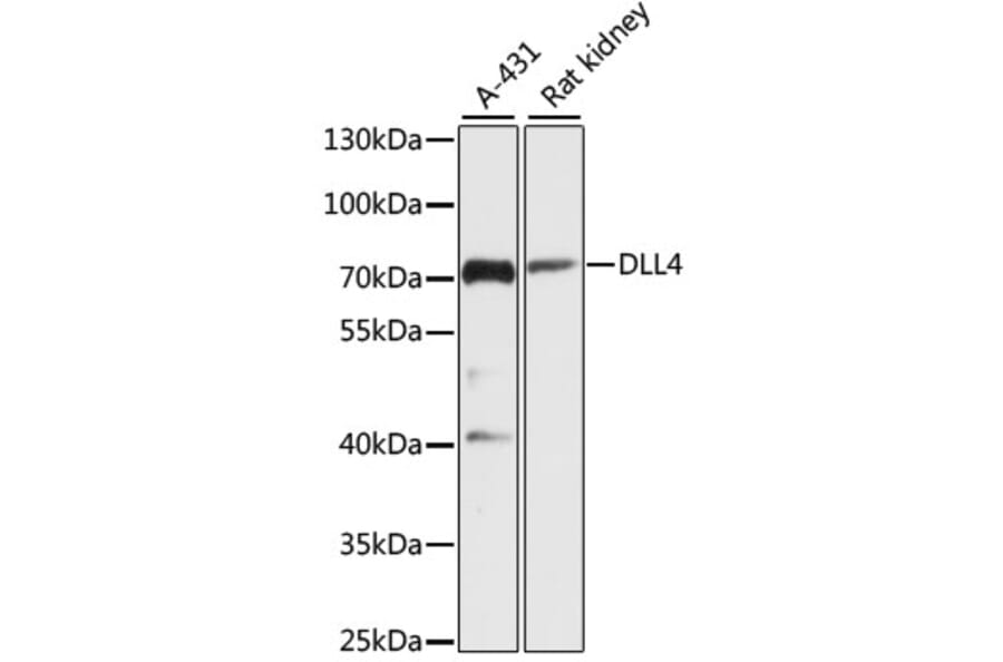 Western Blot - Anti-DLL4 Antibody (A91142) - Antibodies.com
