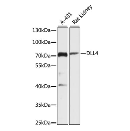 Western Blot - Anti-DLL4 Antibody (A91142) - Antibodies.com