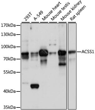 Western blot analysis of extracts of various cell lines, using Anti-ACSS1 Antibody (A15007) at 1:1,000 dilution.
Secondary antibody: Goat Anti-Rabbit IgG (H+L) (HRP) (AS014) at 1:10,000 dilution.
Lysates / proteins: 25µg per lane.
Blocking buffer: 3% non-fat dry milk in TBST.
Detection: ECL Basic Kit (RM00020).
Exposure time: 10s.