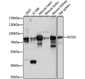 Western Blot - Anti-ACSS1 Antibody (A91143) - Antibodies.com