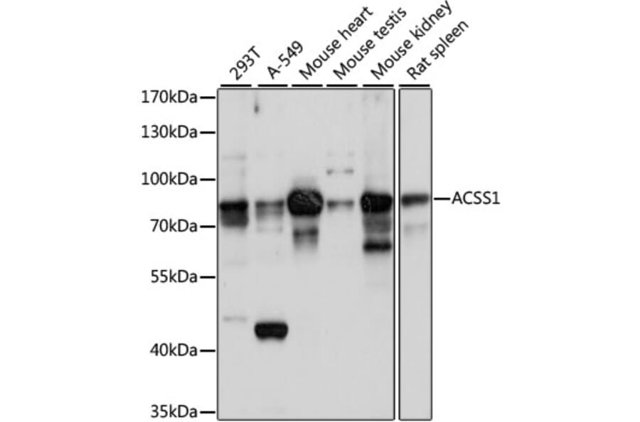 Western Blot - Anti-ACSS1 Antibody (A91143) - Antibodies.com