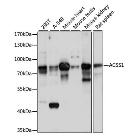 Western Blot - Anti-ACSS1 Antibody (A91143) - Antibodies.com