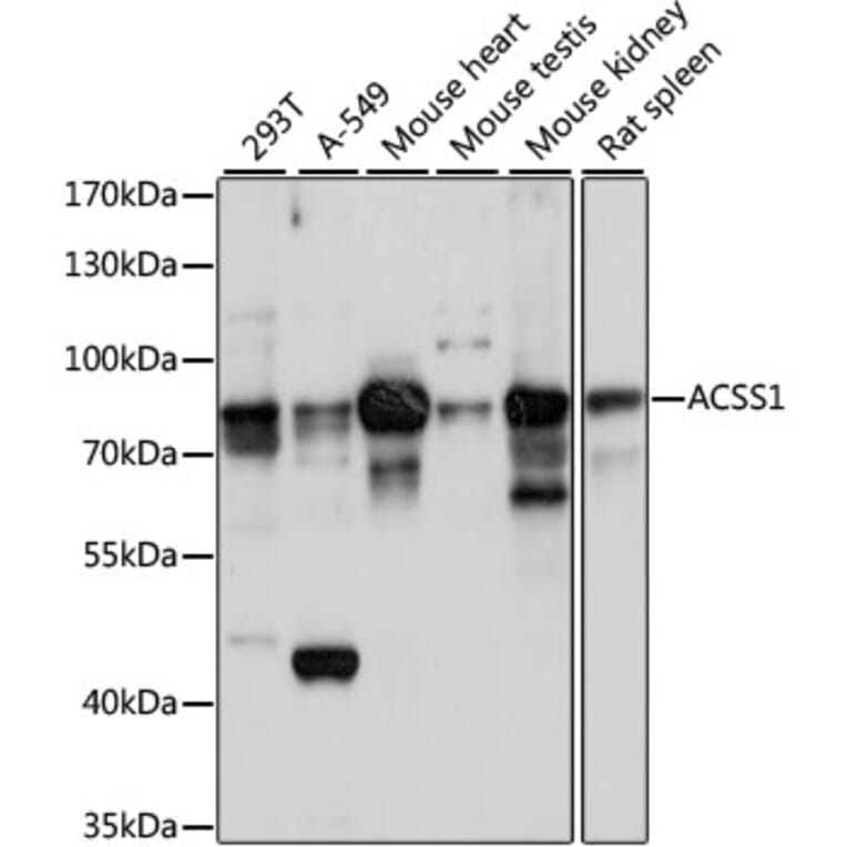 Western Blot - Anti-ACSS1 Antibody (A91143) - Antibodies.com