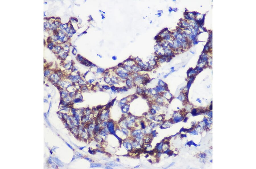 Immunohistochemistry - Anti-ACSS1 Antibody (A91143) - Antibodies.com