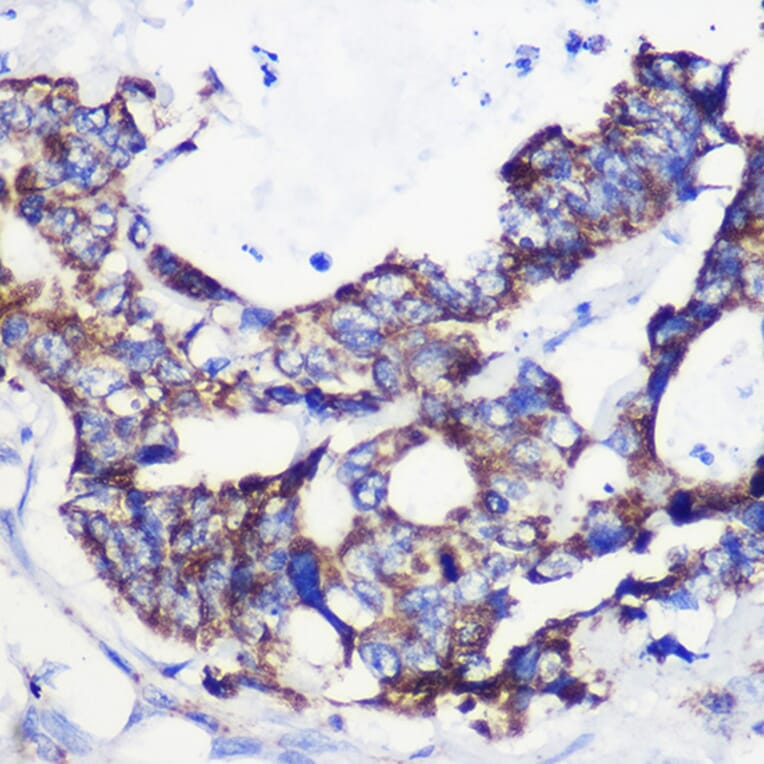 Immunohistochemistry - Anti-ACSS1 Antibody (A91143) - Antibodies.com