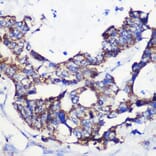 Immunohistochemistry - Anti-ACSS1 Antibody (A91143) - Antibodies.com