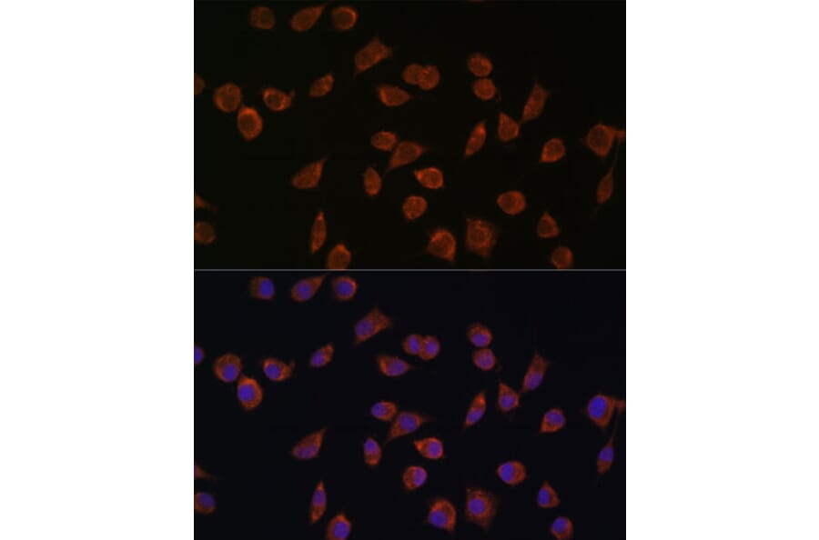 Immunofluorescence - Anti-ACSS1 Antibody (A91143) - Antibodies.com