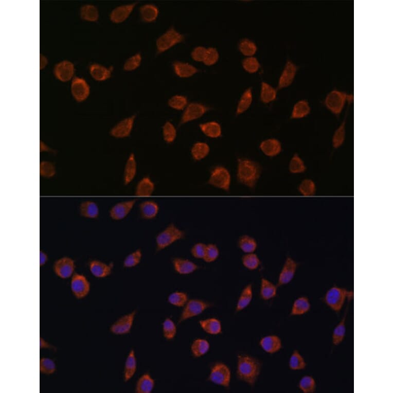 Immunofluorescence - Anti-ACSS1 Antibody (A91143) - Antibodies.com