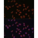 Immunofluorescence - Anti-ACSS1 Antibody (A91143) - Antibodies.com
