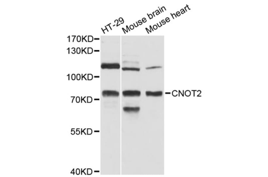 Western Blot - Anti-CNOT2 Antibody (A12832) - Antibodies.com