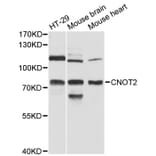 Western Blot - Anti-CNOT2 Antibody (A12832) - Antibodies.com