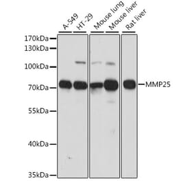 Western Blot - Anti-MMP25 Antibody (A91145) - Antibodies.com