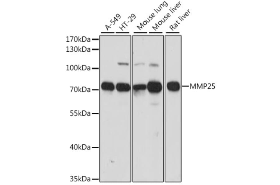 Western Blot - Anti-MMP25 Antibody (A91145) - Antibodies.com