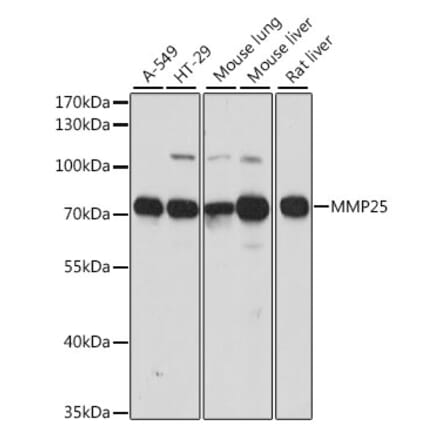 Western Blot - Anti-MMP25 Antibody (A91145) - Antibodies.com