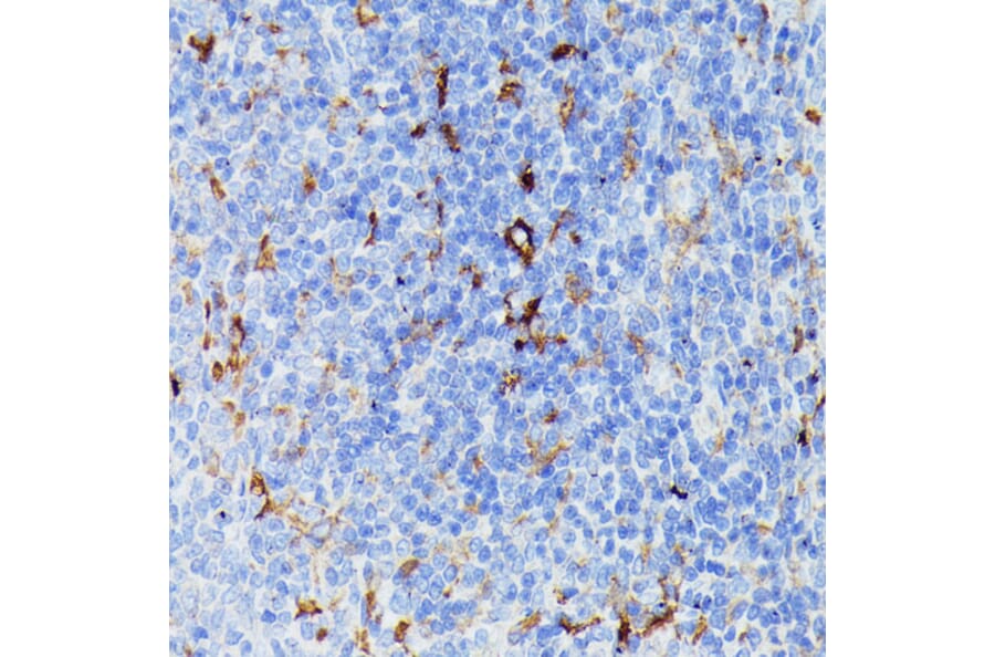 Immunohistochemistry - Anti-MMP25 Antibody (A91145) - Antibodies.com