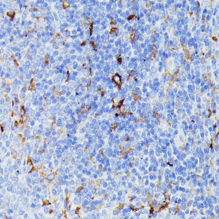Immunohistochemistry - Anti-MMP25 Antibody (A91145) - Antibodies.com