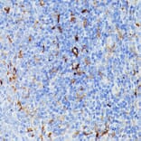 Immunohistochemistry - Anti-MMP25 Antibody (A91145) - Antibodies.com