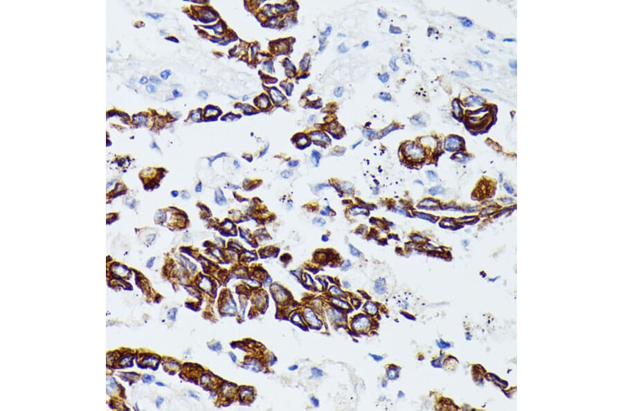 Immunohistochemistry - Anti-MMP25 Antibody (A91145) - Antibodies.com