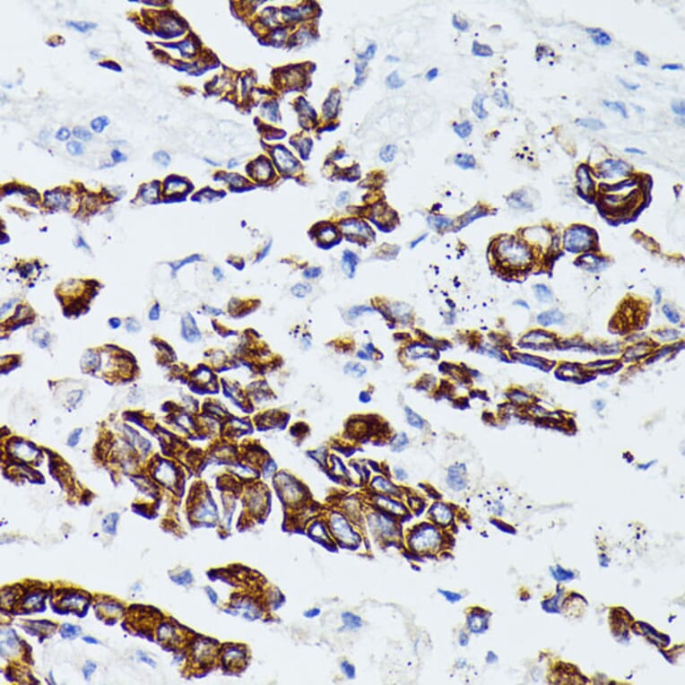 Immunohistochemistry - Anti-MMP25 Antibody (A91145) - Antibodies.com