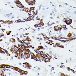 Immunohistochemistry - Anti-MMP25 Antibody (A91145) - Antibodies.com