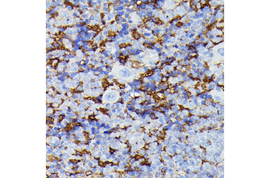 Immunohistochemistry - Anti-MMP25 Antibody (A91145) - Antibodies.com