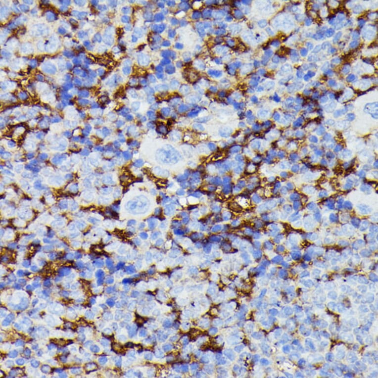 Immunohistochemistry - Anti-MMP25 Antibody (A91145) - Antibodies.com