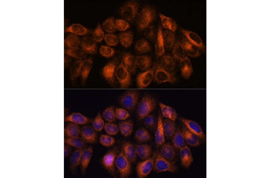 Immunofluorescence - Anti-MMP25 Antibody (A91145) - Antibodies.com
