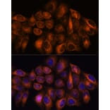 Immunofluorescence - Anti-MMP25 Antibody (A91145) - Antibodies.com