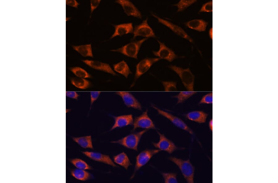 Immunofluorescence - Anti-MMP25 Antibody (A91145) - Antibodies.com