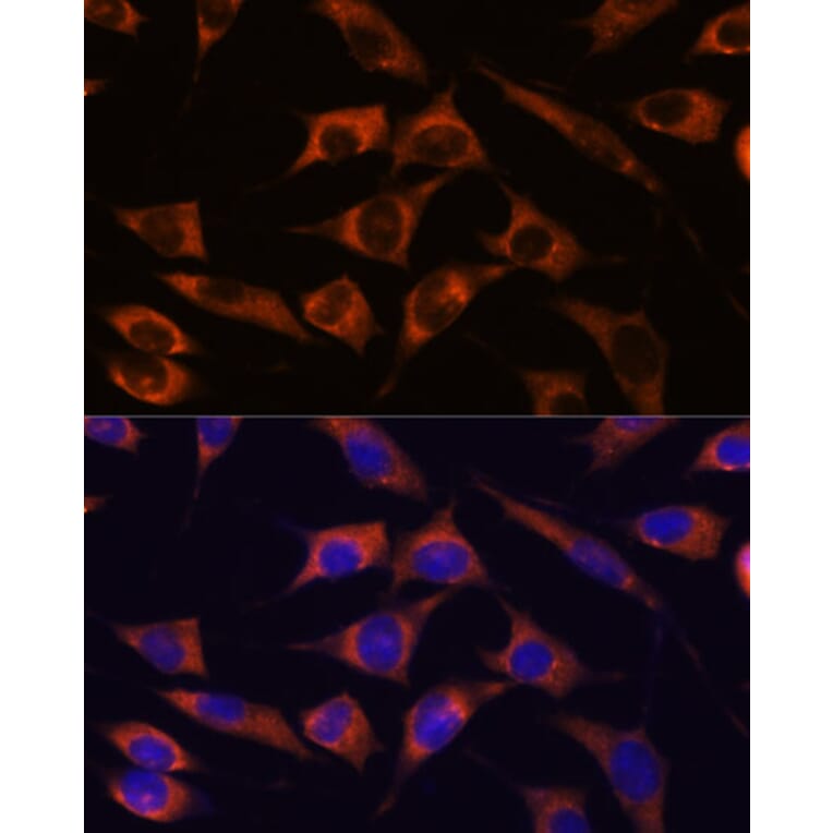 Immunofluorescence - Anti-MMP25 Antibody (A91145) - Antibodies.com