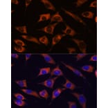 Immunofluorescence - Anti-MMP25 Antibody (A91145) - Antibodies.com