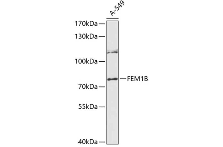 Western Blot - Anti-FEM1B Antibody (A91146) - Antibodies.com